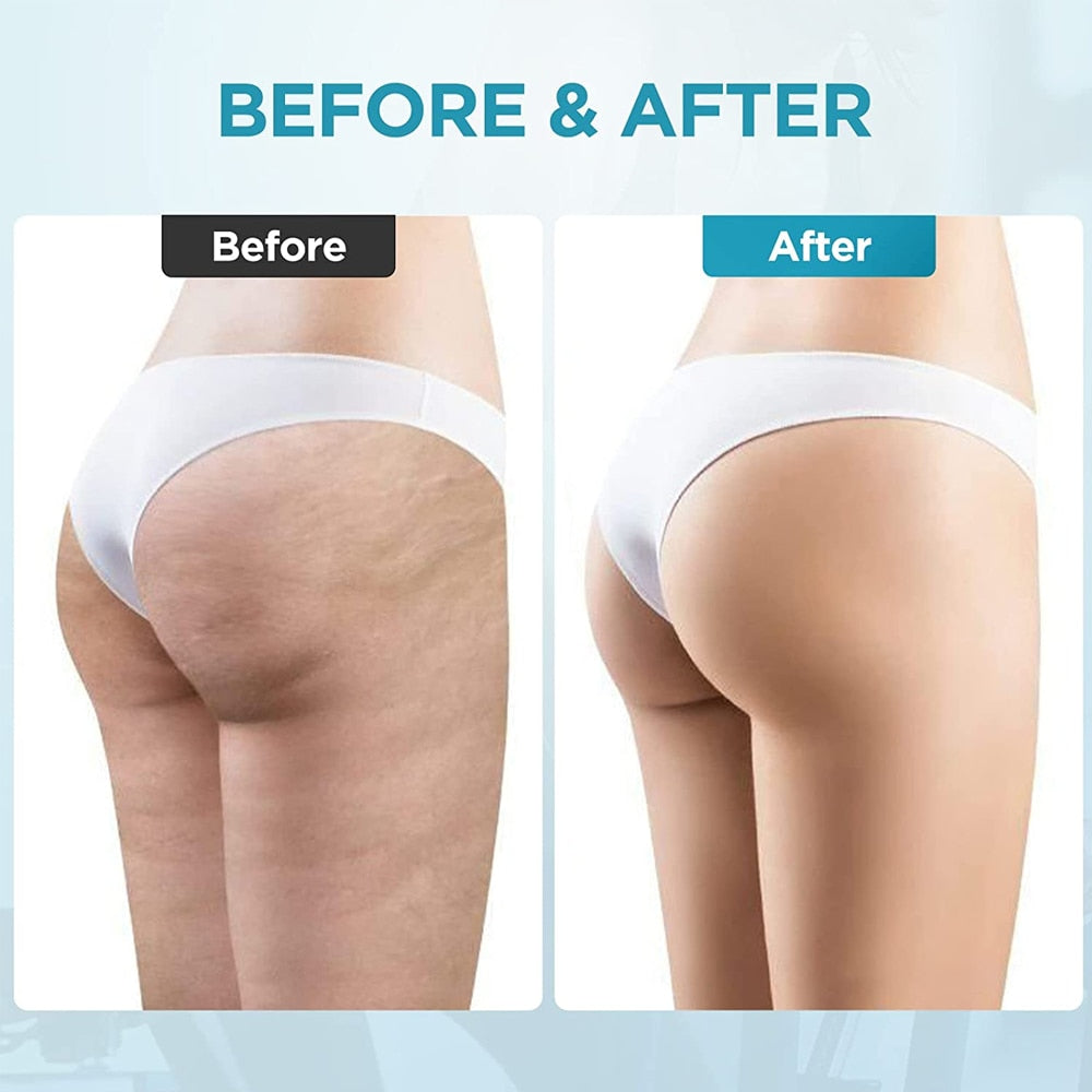 Manual Trigger Point